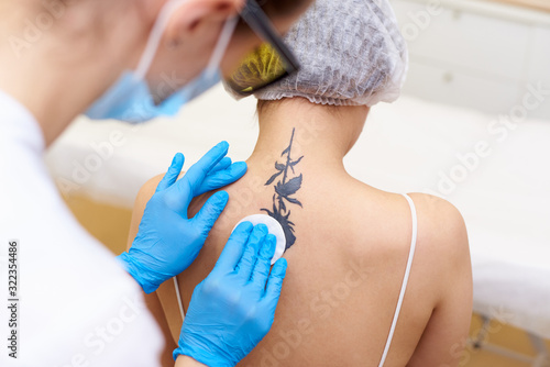 Laser tattoo removal in a cosmetology clinic.