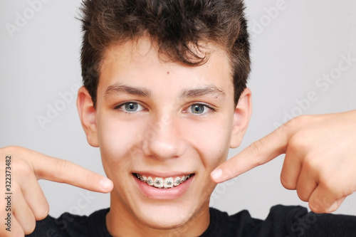 A pretty teenager on a gray background. He points his fingers of both hands on braces on his teeth and smile photo