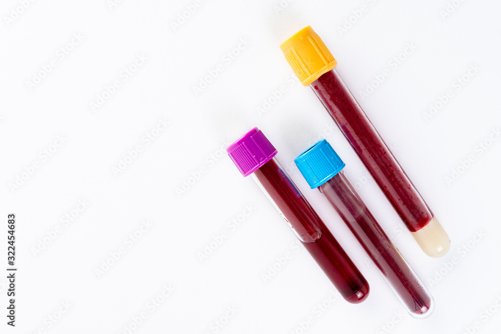 Blood test tube on white background. Top view. Blood test tube on white background. Top view.