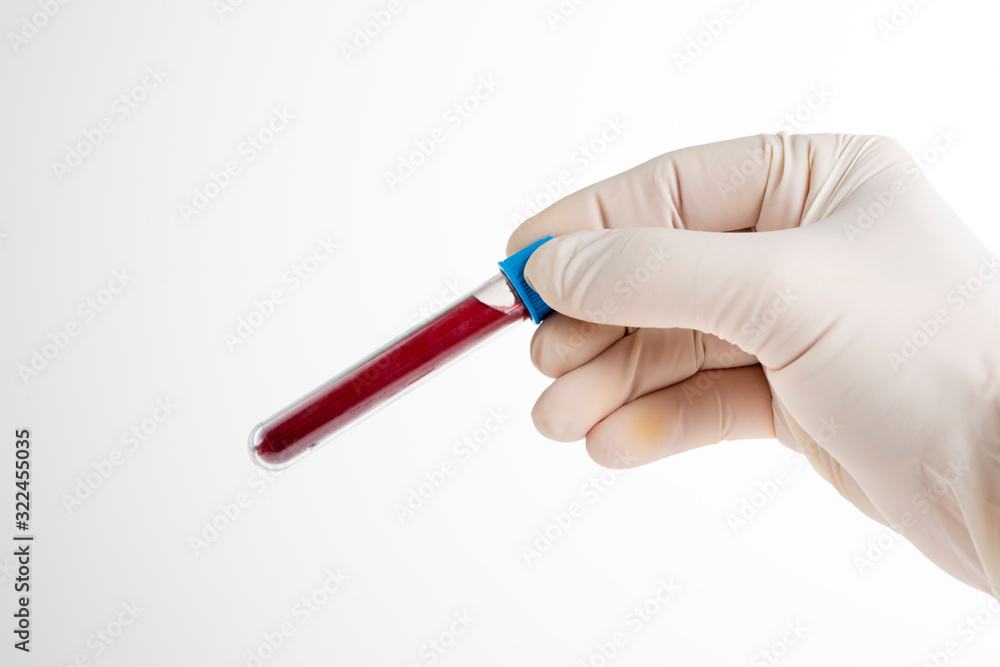 Male nurse holding blood test on white background. Space for text. Male nurse holding blood test on white background. Space for text.