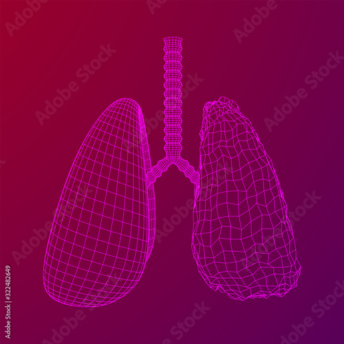 Healthy and sick lung with trachea bronchi internal organ human. Pulmonology medicine science technology concept. Wireframe low poly mesh vector illustration