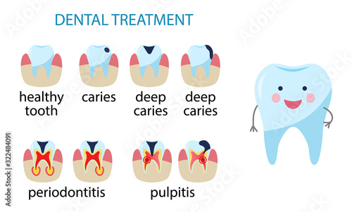 Dental treatment poster. Icon Diseases of teeth. caries, pulpitis, periodontitis. Human tooth in flat style. Vector illustration isolated on white,