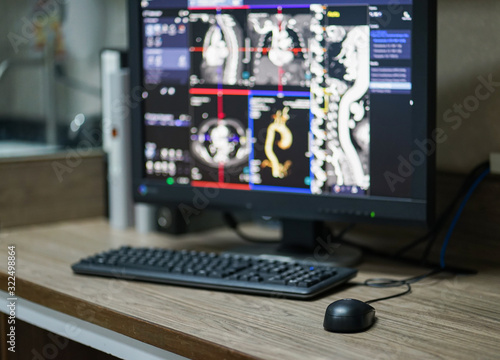 CT scan workstaion with blur Computed Tomography Angiogram(CTA) abdominal aorta background.