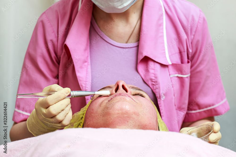 Cosmetologist uses a brush to apply a soothing, transparent mask to the reddened skin of the patient's face, after chemical peeling.
