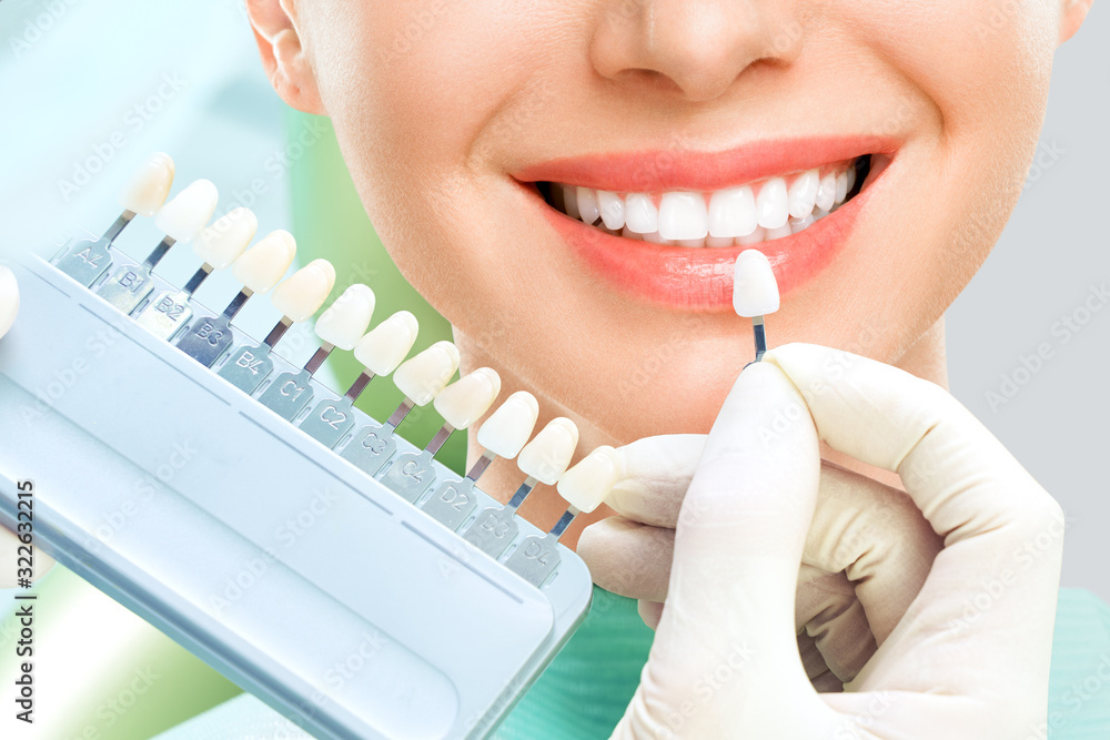 Φωτογραφία Close up portrait of Young women in dentist chair, Check and select the color of the teeth