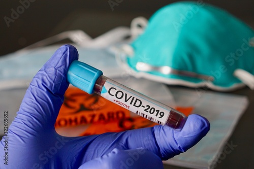 COVID-2019, the name chosen by WHO for the new rapidly spreading Coronavirus outbreak that originated in Wuhan, China