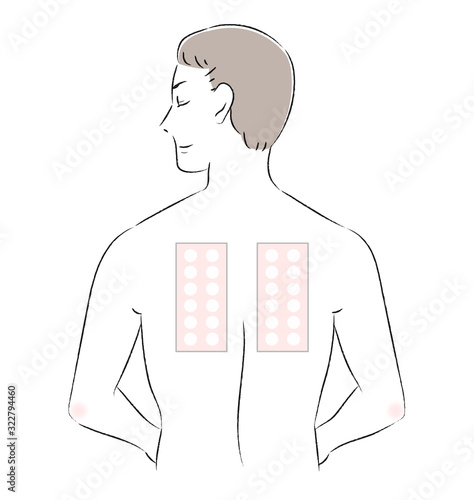 男性　背中　パッチテスト　スティンギングテスト