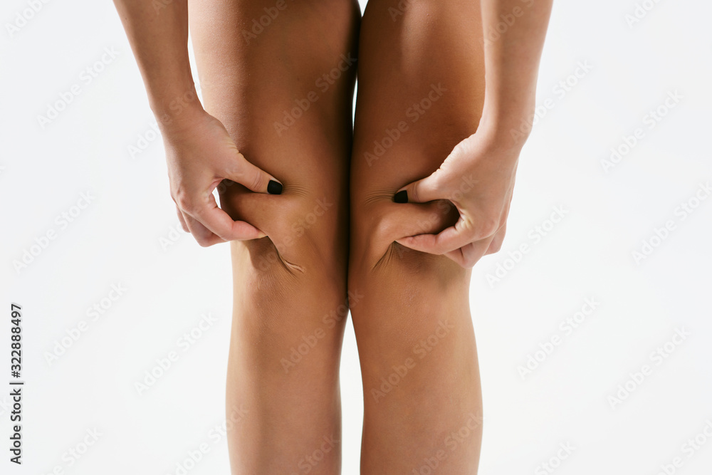 Problem of women body concept: cellulite, weight loss, fat, varicose veins. Sexy young woman in lingerie with slim body sitting on a diet. Sports, fitness, plastic surgery and aesthetic cosmetology Problem of women body concept: cellulite, weight loss, fat, varicose veins. Sexy young woman in lingerie with slim body sitting on a diet. Sports, fitness, plastic surgery and aesthetic cosmetology