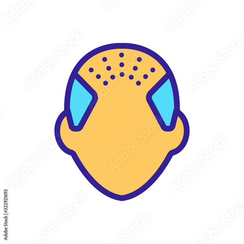 baldness icon vector. Thin line sign. Isolated contour symbol illustration