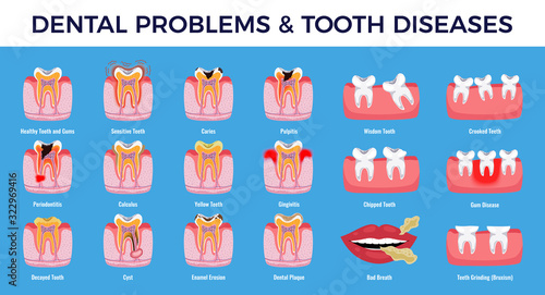 Dental Problems Diseases Infographic Set 