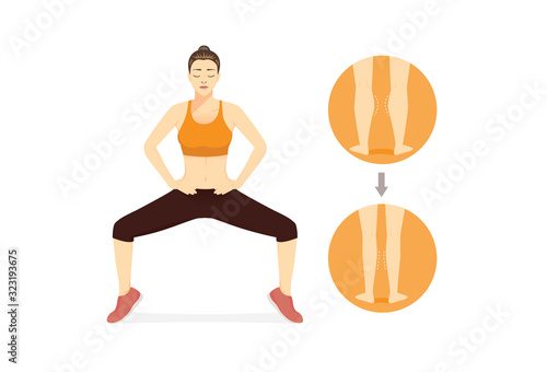 Woman doing Sumo Squat With Calf Raises for get rid fat leg, calf and thighs. Illustration about workout for beauty shape of women.