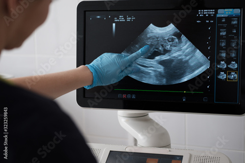 Doctor uses ultrasound scan in veterinary clinic photo