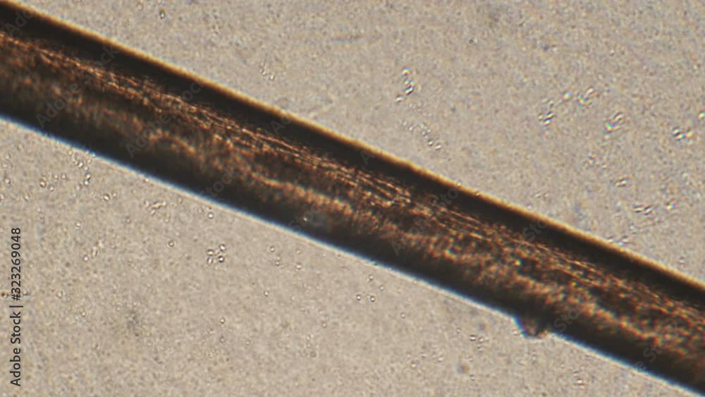 Microscopy of human hair (eyelash and eyebrow). Magnification 150x root ...
