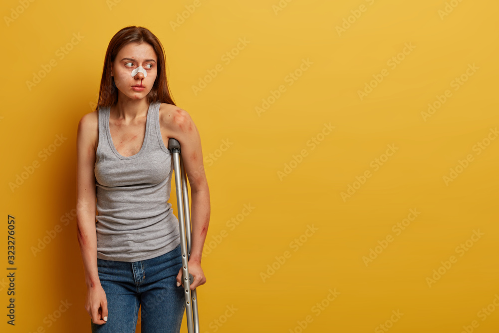 Unskilled driver has various bruises and broken legs after bike