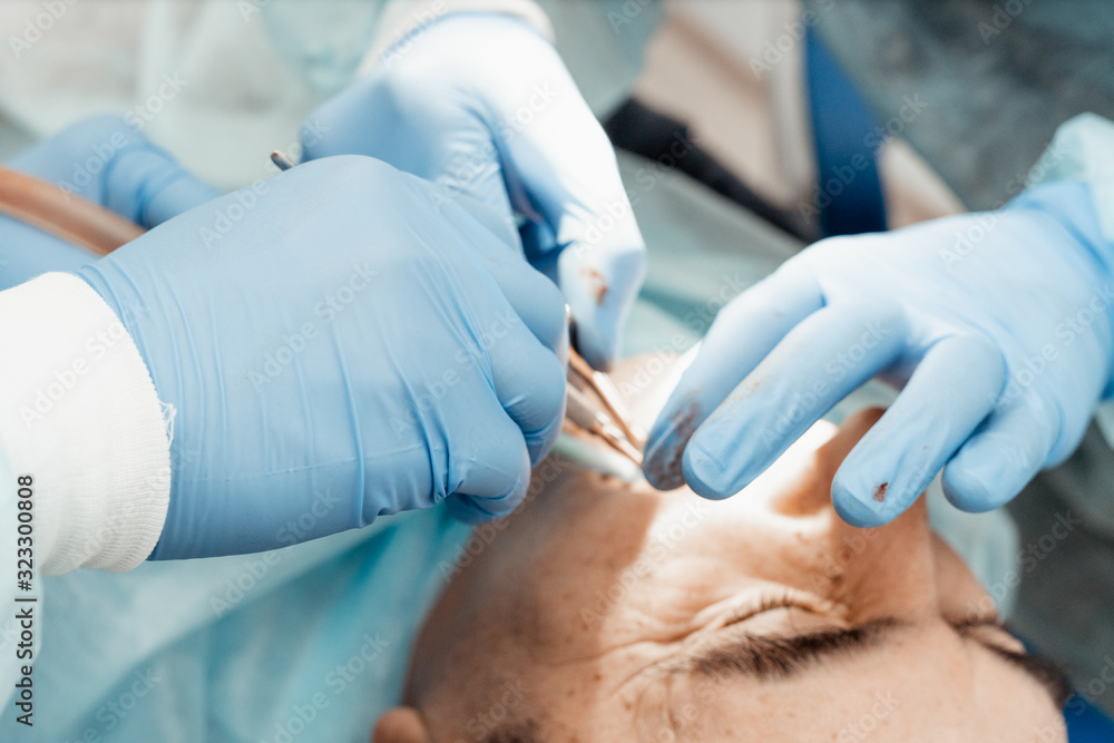 Dentists will perform an operation, implant placement. Real operation. Tooth extraction, implants. Professional uniform and equipment of a dentist. Healthcare Equipping a doctor’s workplace. Dentistry Dentists will perform an operation, implant placement. Real operation. Tooth extraction, implants. Professional uniform and equipment of a dentist. Healthcare Equipping a doctor’s workplace. Dentistry