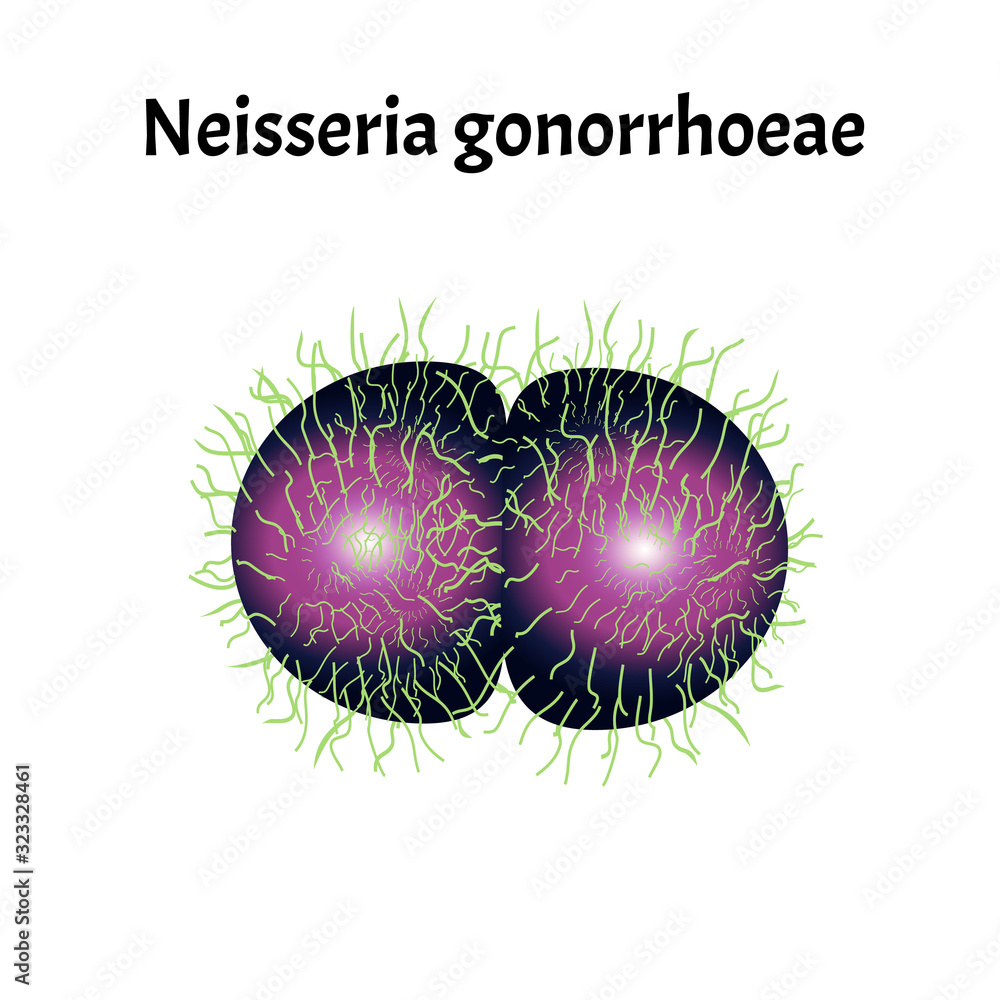 Gonococcus structure. Neisseria gonorrhoeae. Gonorrhea disease ...