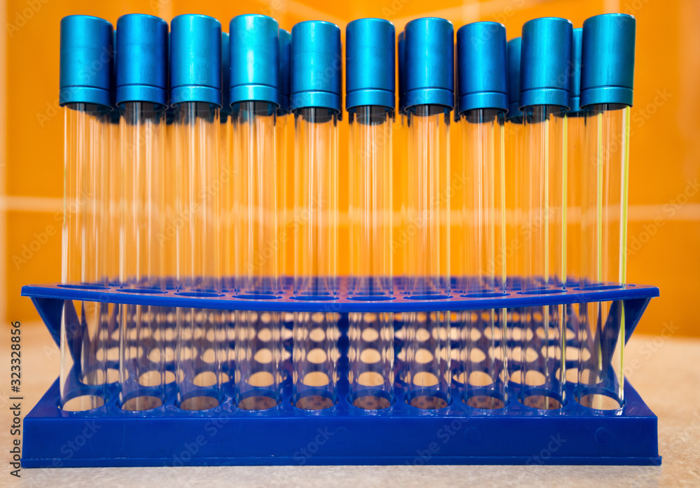 Laboratory test tubes on a stand. Laboratory test tubes on a stand.
