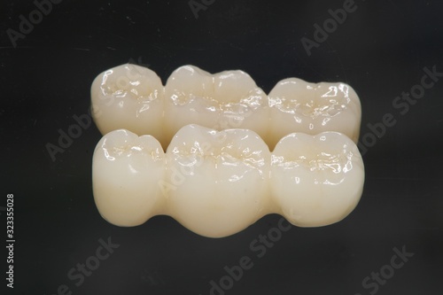 審美歯科 ジルコニアクラウン