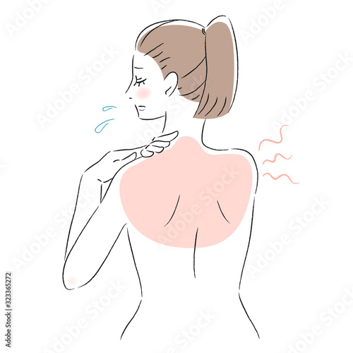 背中　肌　悩み　日焼け　女性