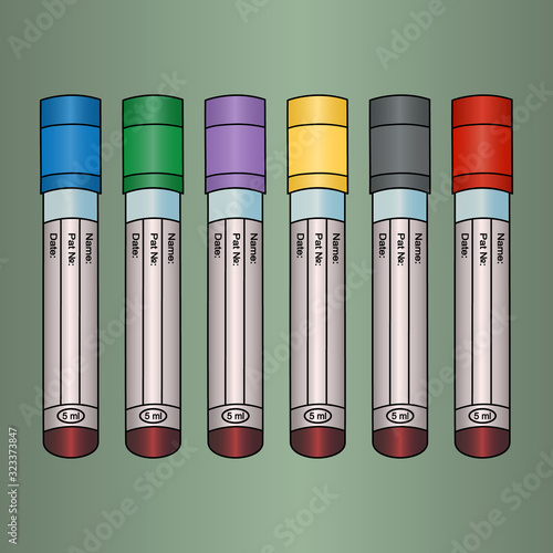 Tubes with blood tests of patients. Set of vector illustrations. Isolated pistachio background. Place for your text. Various types of research. Plasma diagnostics. Collection with colored caps. 
