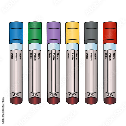 Tubes with blood tests of patients. Set of vector illustrations. Isolated background. Place for your text. Various types of research. Plasma diagnostics. Collection with colored caps. Medical topics.