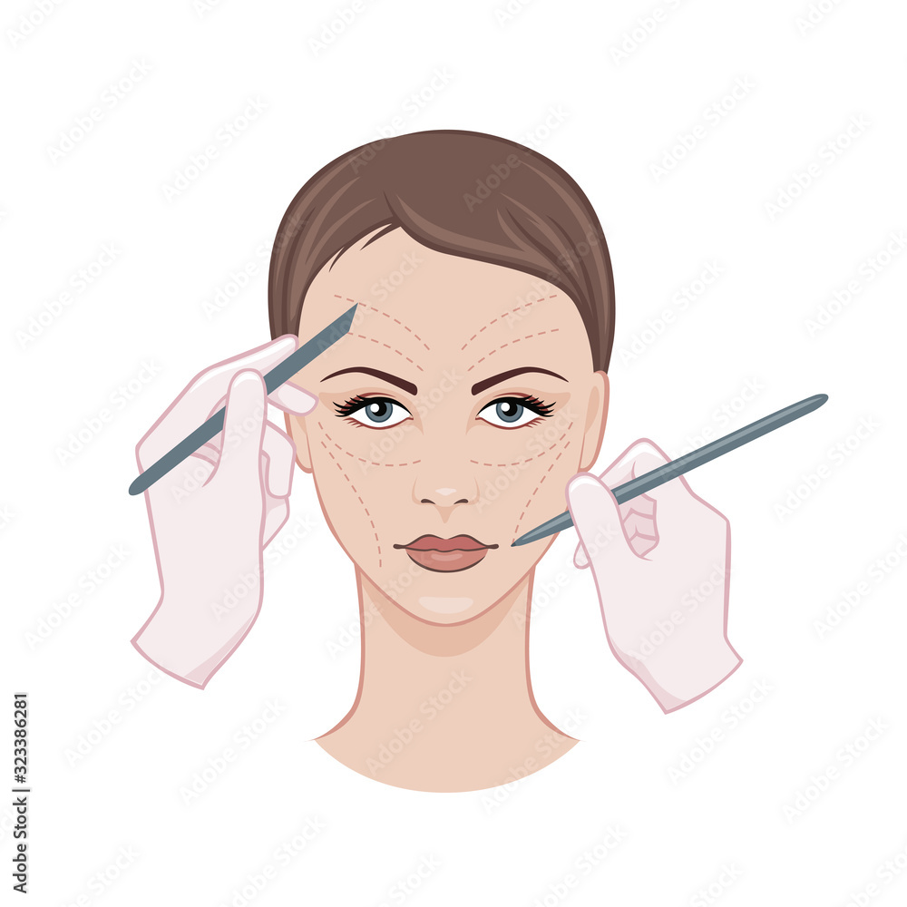Doctor hands with scalpel and pencil touching woman with perforation lines on face isolated on white background. Beauty female facial medical plastic surgery concept vector graphic illustration Doctor hands with scalpel and pencil touching woman with perforation lines on face isolated on white background. Beauty female facial medical plastic surgery concept vector graphic illustration
