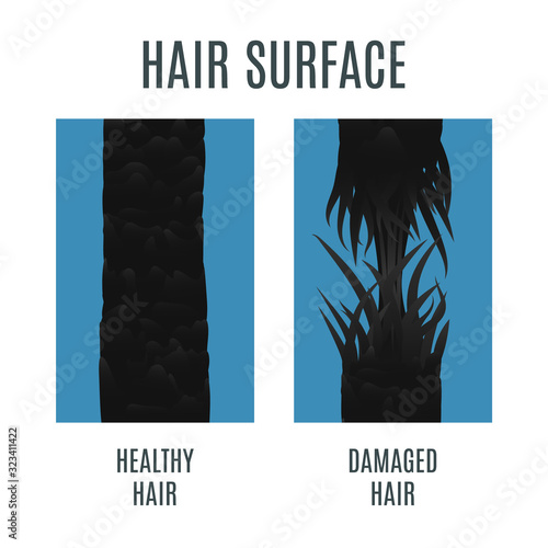 Surface of healthy and breaking damaged hair under the microscope. Hair follicle condition closeup. Trichology before and after medical concept. Vector illustration.