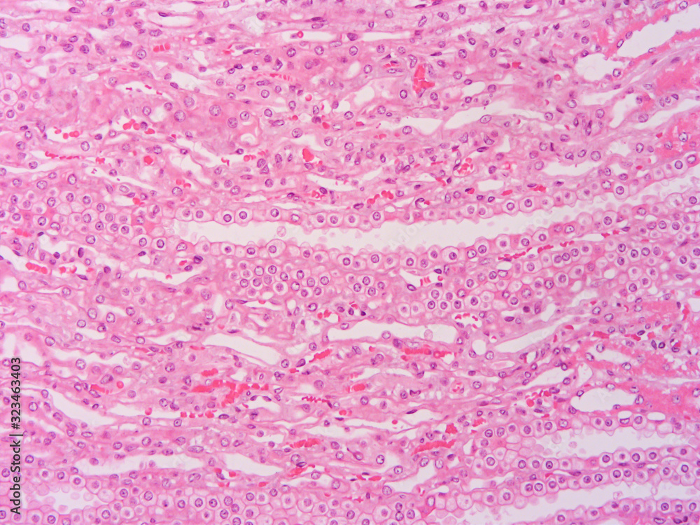 picture of histology human tissue with microscope from laboratory (not Illustration Designation) picture of histology human tissue with microscope from laboratory (not Illustration Designation)