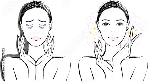 女性　クマ　ビフォーアフター