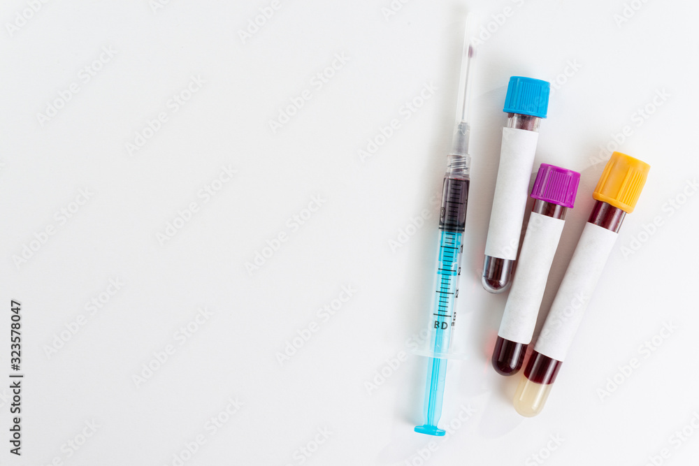 Test tubes with blood isolated and syringe on white. Test tubes with blood isolated and syringe on white.
