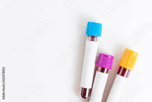 Blood sample in vacuum tube isolated on white background. Top view.