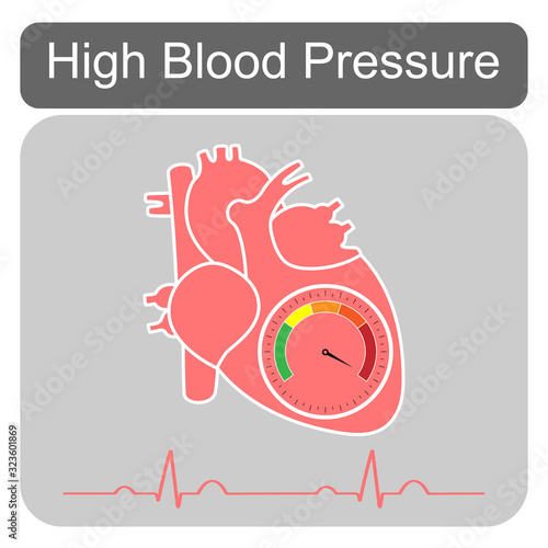 Human cardiac anatomy with speedometer show hypertensive crisis stage and heart beat isolated on grey background.Design for logo.Concept for medical health care.High blood pressure.Vector.