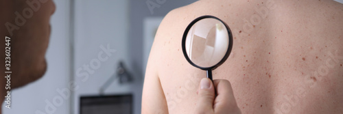 Male doctor look at magnifying glass on patient skin against hospital office background. Lesions danger problem therapy concept