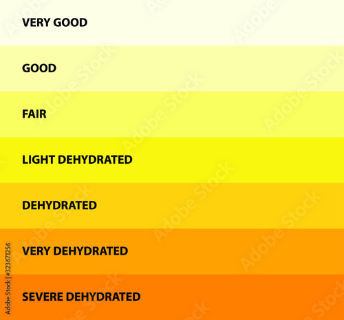 Urine color, Dehydration Urine Color Chart, vector illustration