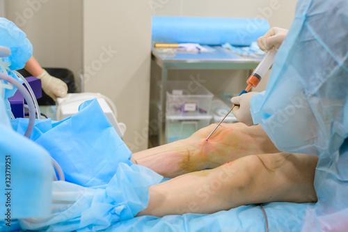 Cosmetic surgery liposuction. The process of removing fat on the legs of a fat woman. Without face, unrecognizable patient.