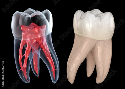 Dental root anatomy - First maxillary molar tooth. Medically accurate dental 3D illustration