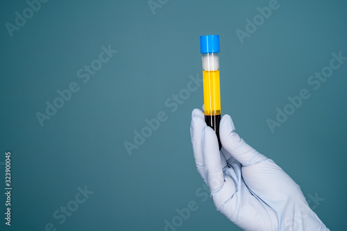 Blood plasma in vitro gloved hand holding