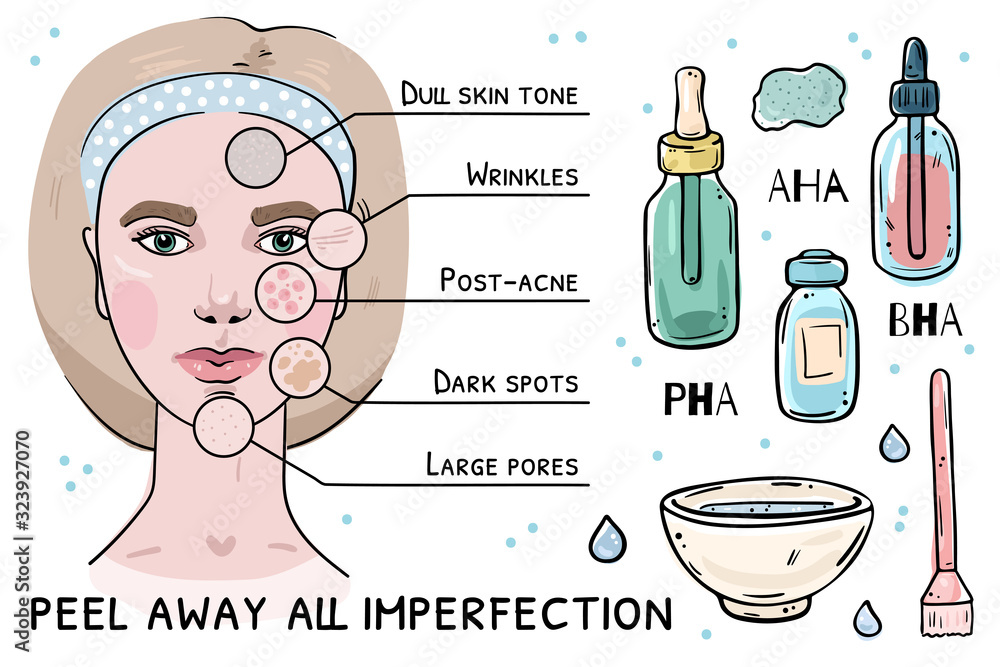 Fototapeta premium Illustration of skin problems that acid peeling solves.