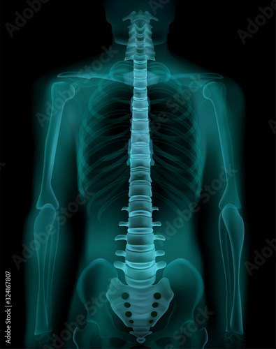Spine X-Ray Realistic Image 