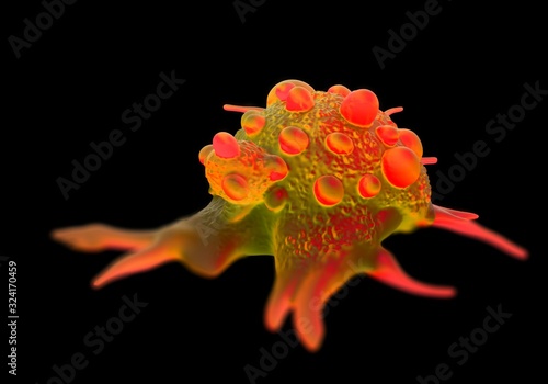 3d illustration - Bladder cancer cells