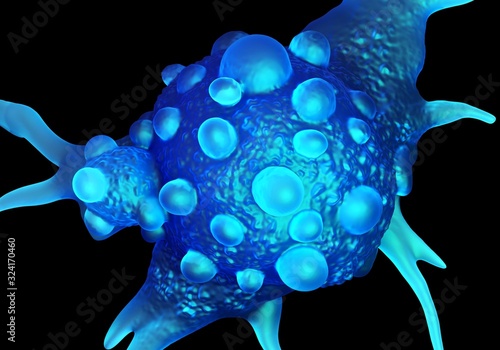 3d illustration - Bladder cancer cells