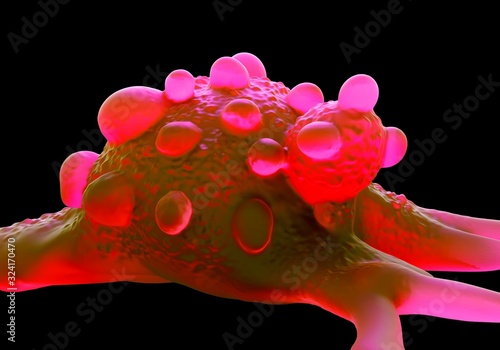 3d illustration - Bladder cancer cells