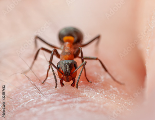 Ameise beißt in Finger © Jürgen Kottmann
