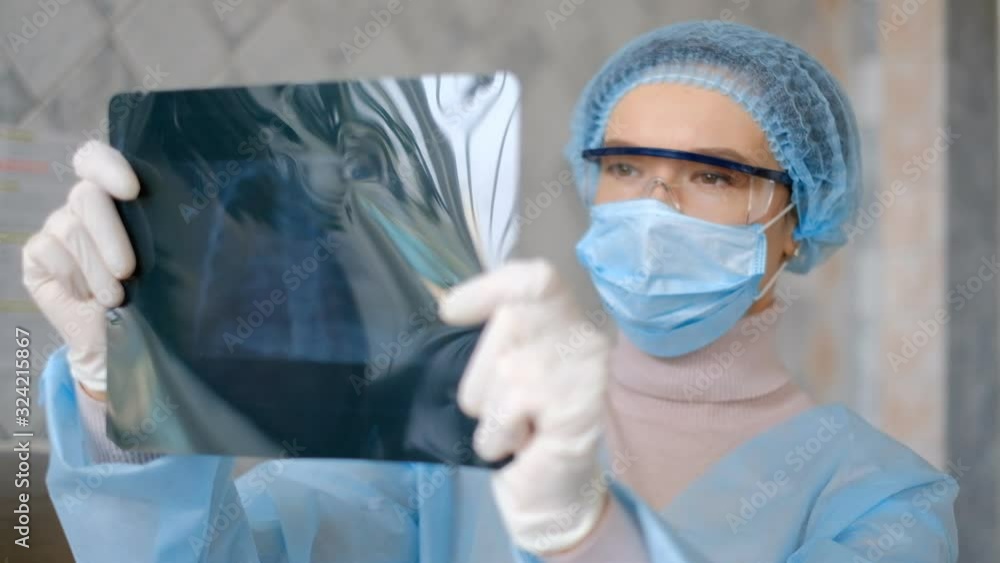 A doctor is looking at a fluorography scan of a patient with coronavirus disease. SARS-CoV-2 A doctor is looking at a fluorography scan of a patient with coronavirus disease. SARS-CoV-2