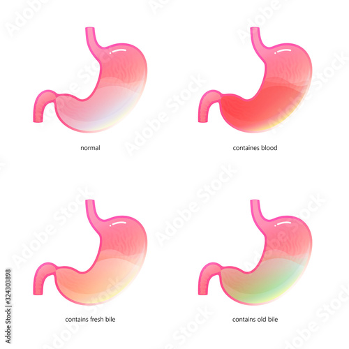 Vector isolated illustration of stomach