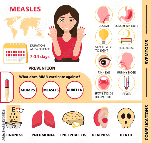 Measles infographic concept vector. Infected human with papules on the skin. Rubeola symptoms and complications illustration. photo