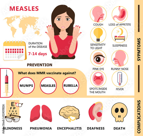 Measles infographic concept vector. Infected human with papules on the skin. Rubeola symptoms and complications illustration.