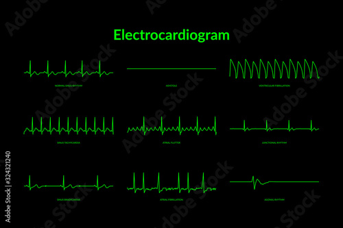Electrocardiogram Heartbeat Line monitor. vector EPS10 Illustration