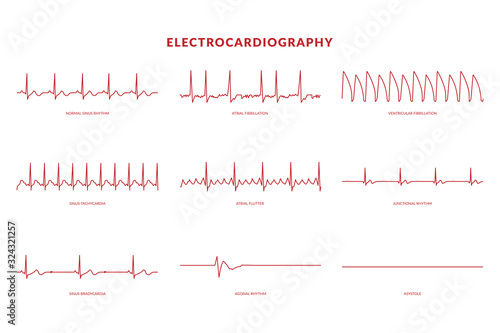 Electrocardiography Heartbeat Line monitor. vector EPS10 Illustration photo