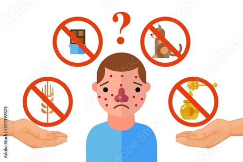 Allergy triggers, unhappy man suffering from allergic reaction, vector illustration. Flat style icons of allergens, chocolate, animal fur, honey and wheat. Sad man with skin rash, set for infographic